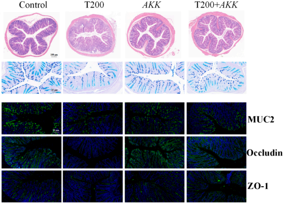 水生所揭示TBPH经肠道菌群—花生四烯酸代谢轴促炎症性肠病发生